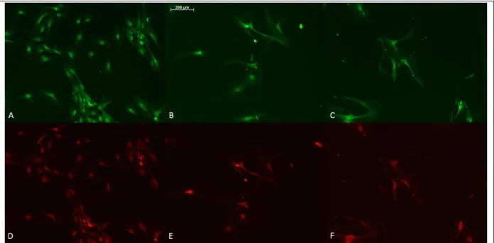 Figure 6: OE4-P5 immunocytochemistry results. (a) BrdU staining and (d) Sox2 staining of the same area