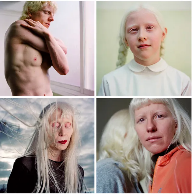 Figure 15 –Paolo de Grenet,  Albino Beauty,  L to R, Dani, Tamara, Ana and Anna (Grenet, 2005) 