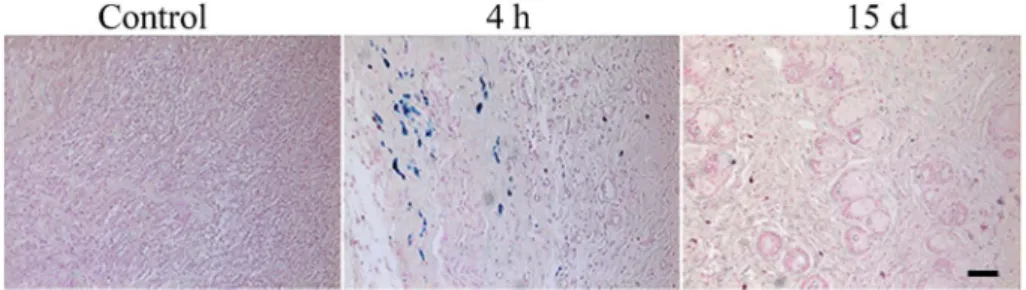 Fig. 6 Prussian blue staining for iron accumulation in the tumor of rats (control) prior to or 4 h and 15 days following the injection of SPION/K-PA (5 mg kg 1 ) (original magni ﬁcation, 200, scale bar represents 50 mm).