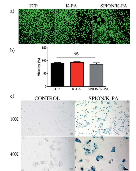 Fig. 4 Viability and Prussian blue staining of HUVECs. (a) Cells were tested for biocompatibility of SPIONs after treatment with K-PA (855 mg mL 1 ) and SPION/K-PA (75 mg mL 1 ) for 24 h by live –dead assay