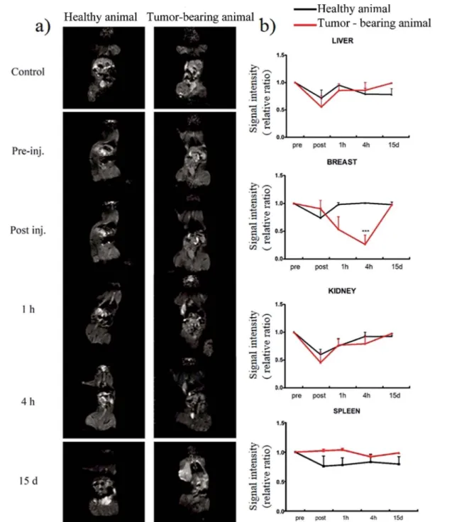 Fig. 5 In vivo MRI. Signal intensity changes in T 2 relaxations at pre-, immediately after injection (post), 1 h, 4 h and 15 d post administration of SPION/K-PA (5 mg kg 1 ) in breast, liver, spleen, kidney and breast tumor of rats