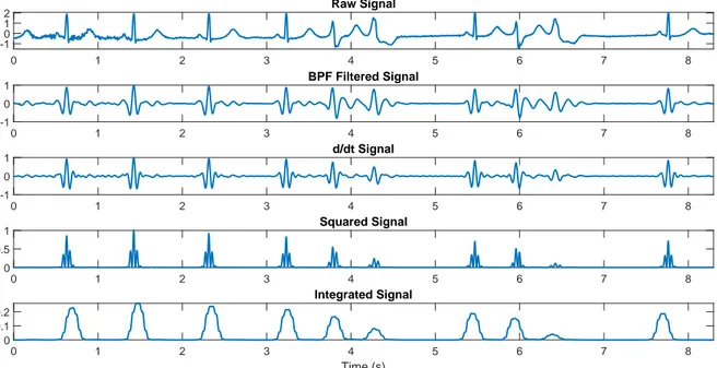 Figure 3.4: The relevant stages Pan-Tompkins algorithm applied to the sample arrhythmic ECG signal.