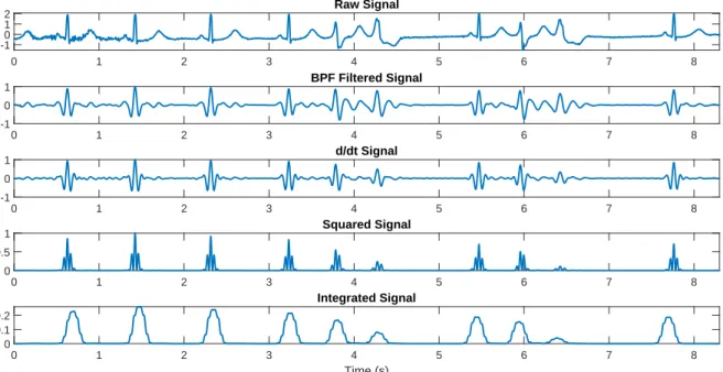 Figure 3.4: The relevant stages Pan-Tompkins algorithm applied to the sample arrhythmic ECG signal.