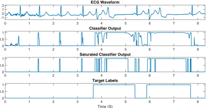Figure 3.6: The ECG sample waveform, MatLab processed outputs, and the target labels.