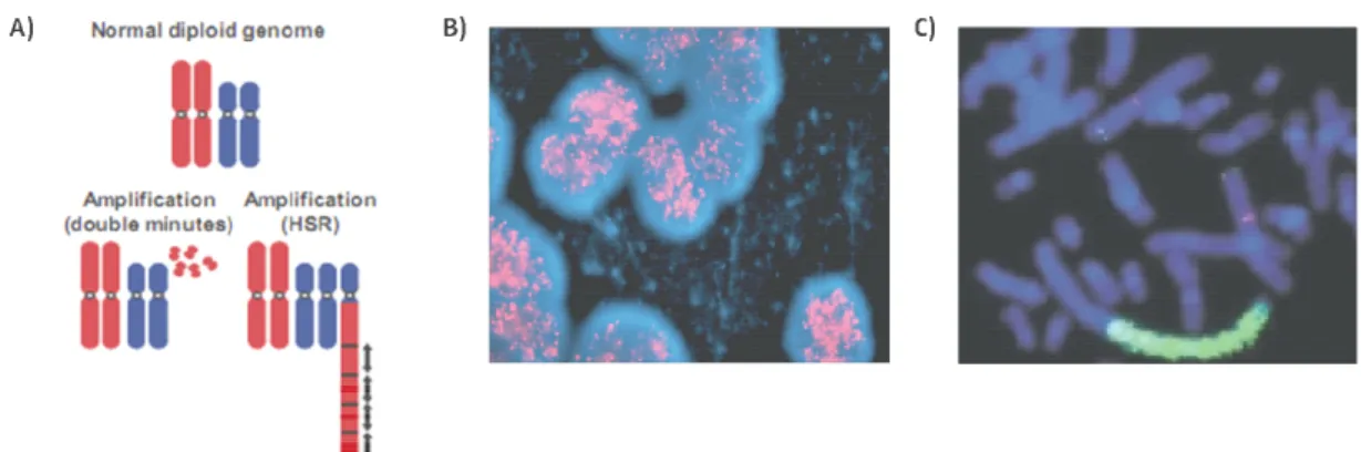 Figure  2:  MYCN  amplification  pattern;  A)  Amplification  patterns  of  double  minutes  (DM)  and  homogenously  staining  regions  (HSR)  are  observed  in  solid  tumors  (Albertson et al., 2003) B) FISH image of MYCN amplification presented in DM (