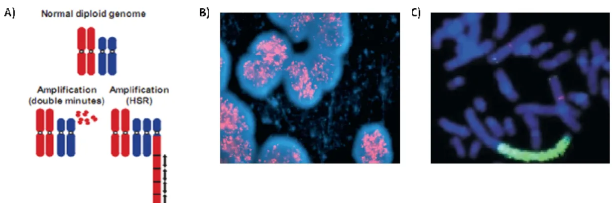 Figure  2:  MYCN  amplification  pattern;  A)  Amplification  patterns  of  double  minutes  (DM)  and  homogenously  staining  regions  (HSR)  are  observed  in  solid  tumors  (Albertson et al., 2003) B) FISH image of MYCN amplification presented in DM (