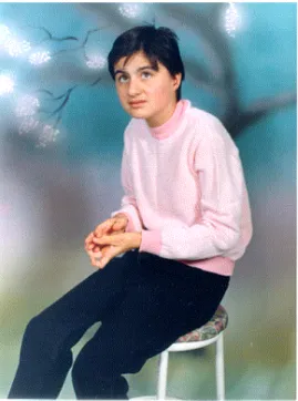 Figure 1.  A girl with classical RTT phenotype.