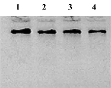 Figure 12. DNA isolation by using phenol/chloroform extraction method Samples were electrophoresed through a 1% agarose gel at 8V/cm for 35 min.
