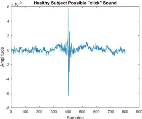 Figure 3.4: Possible “Click” Sound Data