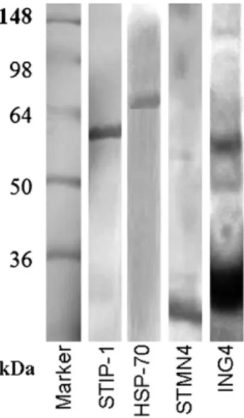 Fig. 2. Silver-stained 10% SDS-PAGE analysis of puriﬁcation of stress-induced- stress-induced-phosphoprotein 1 (STIP-1), heat-shock protein 70 (Hsp-70), stathmin-like 4 (STMN4) and inhibitor of growth family, member 4 (ING4)