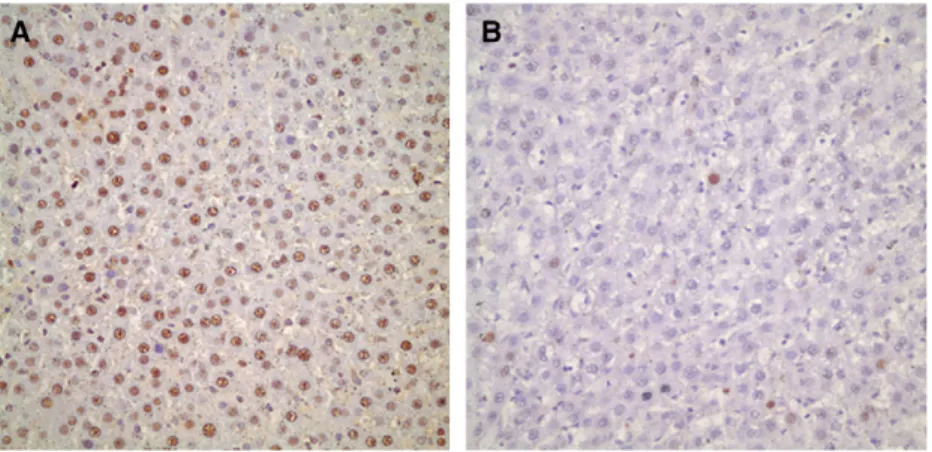 Fig 2. (A) Immunohistochemical staining for PCNA . On the first day after 70% hepatectomy more than 90% of hepa- hepa-tocytes were positive for PCNA