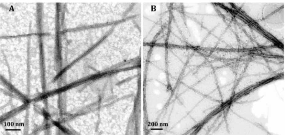 Figure 4. Uptake of BODIPY conjugated GM3-MIM and morphological changes of iDCs when treated with (A) Man-PA/GM3-MIM, (B) Glc-PA/GM3-MIM, and (C) only GM3-MIM for 24 h