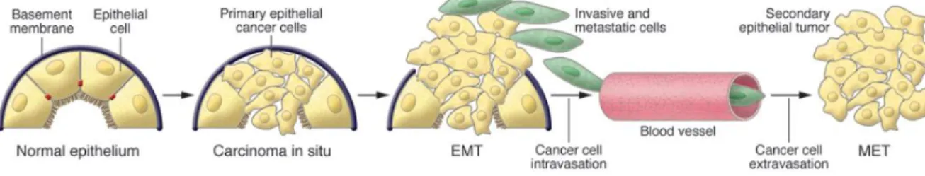Figure 1.3 [15]: Contribution of EMT to cancer progression. 
