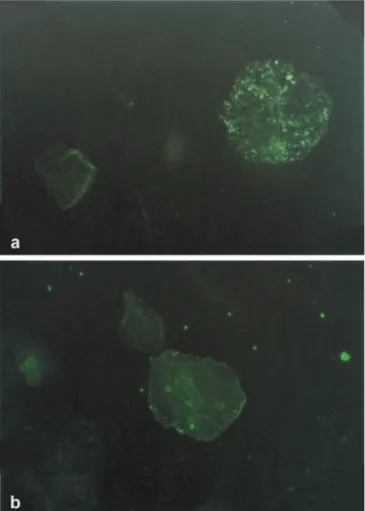 Fig. 2. Immunostaining of ganglioside GM2 (a) showing diﬀuse granular staining on pharyngeal epithelial cells