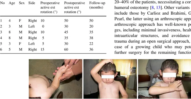 Fig. 2 Three-year-old male patient. Twelve months after surgery showing external rotation, hand to head, and hand to mouth motion