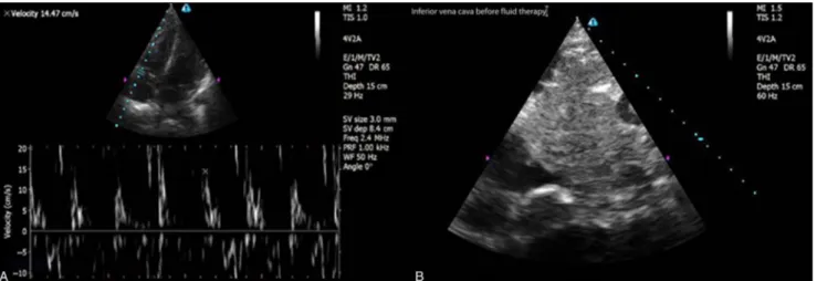 Fig. 1. (A) Bedside ultrasound (BUS) performed by the emergency department (ED) physician revealed increased TDI velocity of the right ventricle from the lateral annulus of the tricuspid valve