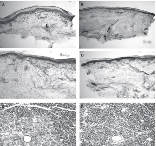 Figure 6 depicts the analysis for acetone. Hindpaw withdrawal to acetone can only be assessed for the entire hindpaw, as the acetone spreads to cover both the sural- and tibial-innervated study sites