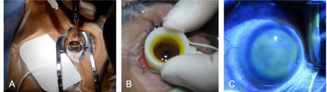 FIGURE 1. A, Application of 10%