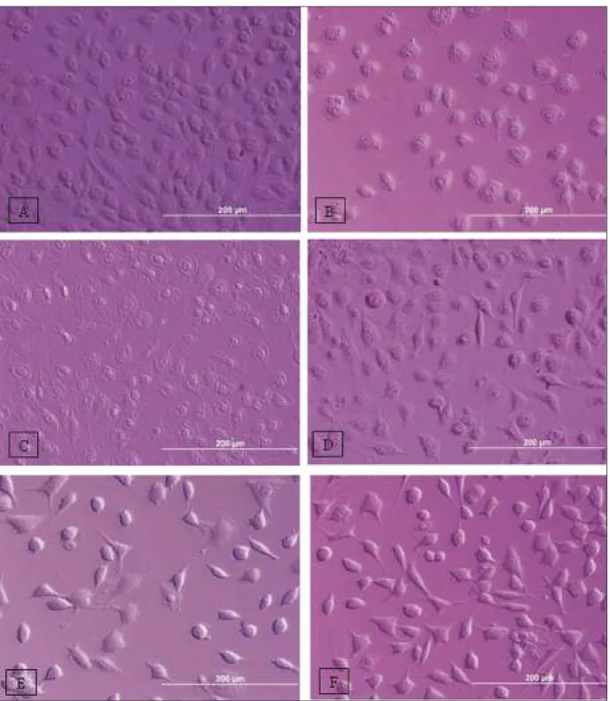 FIGURE 1: Cell morpology after 2 h incubation in different dilutions of Nasodren. A, B, C, D, E and F represent 1:25, 1:50, 1:100, 1:200, 1:400 dilutions of Na- Na-sodren and control, respectively (10x20).
