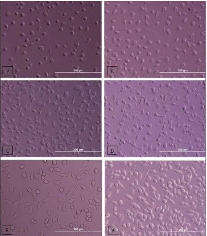 FIGURE 2: Cell morpology on day 1 in different dilutions of Nasodren. A, B, C, D, E and F represent 1:25, 1:50, 1:100, 1:200, 1:400 dilutions of Nasodren and control, respectively (10x20)