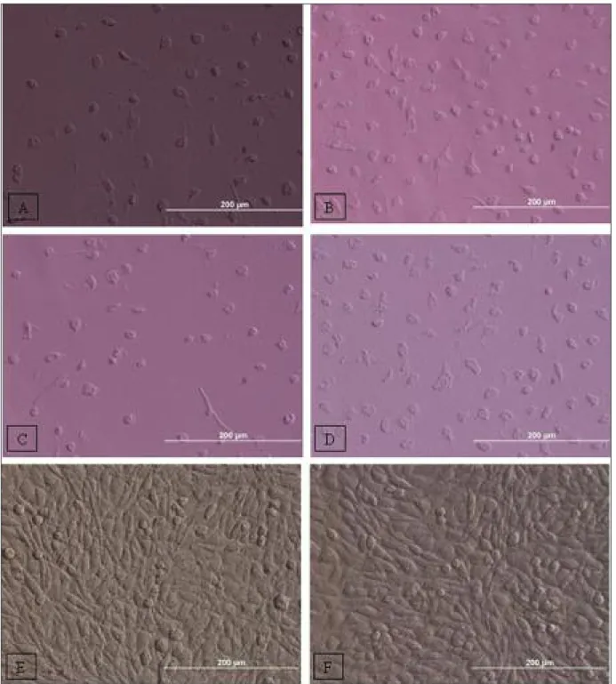 FIGURE 5: Cell morpology at day 4 in different dilutions of Nasodren. A, B, C, D, E and F represent 1:25, 1:50, 1:100, 1:200, 1:400 dilutions of Nasodren and control, respectively (10x20).