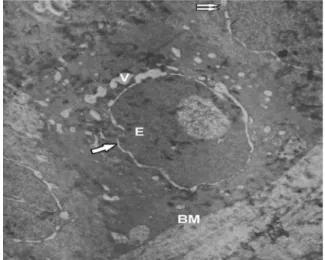 Figure 4 - High  dose  treated  group:  E  -  epithelium,  BM  -  basement  membrane, A - apoptotic body, (Uranyl acetate - lead citrate  X3000).