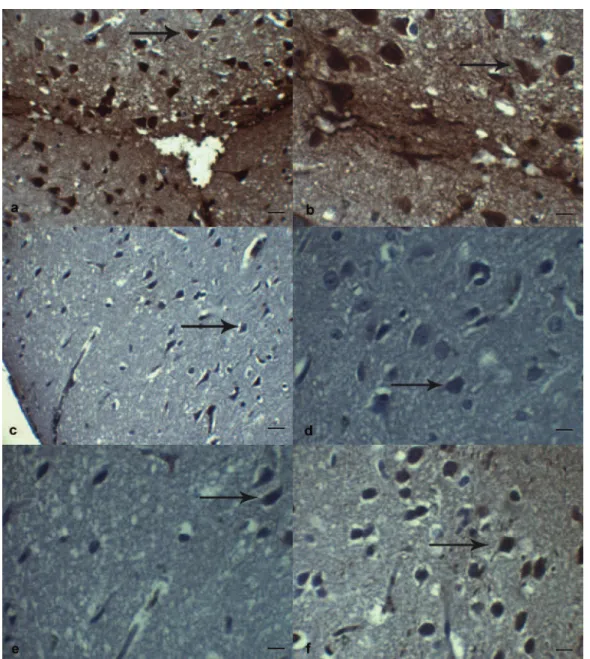 Figure 4.  Photomicrographs showing TNF-α immunoreactivity at motor neurons in the perilesionel cortex