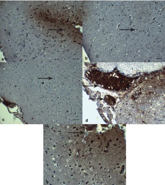Figure 4.  TNF-α immunoreactivities at glial and endothelial cells in the perilesionel cortex