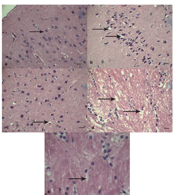 Figure  1.  Neuronal morphology indicated by hematoxylin-eosin staining. A, Histological appearances of normal brain parenchyma in Sham group