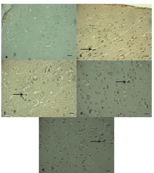 Figure 2.  TUNEL immunohistochemistry staining in the perilesional region of the cortex of the brain following TBI