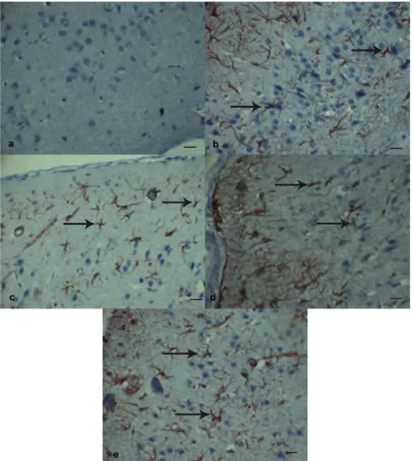 Figure 3.  Immunohistochemistry for GFAP in the perilesional region of the cortex of the brain following TBI