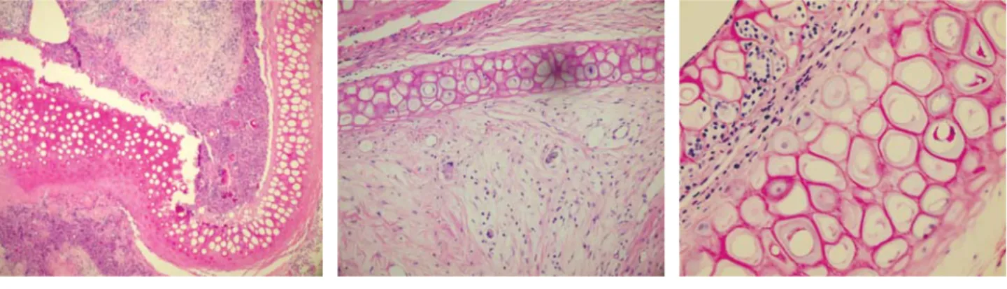 FIGURE 1.  Totally empty lacunas and defi - -nite foreign body (environmental reaction)  in sliced cartilage group (H&amp;E x100).