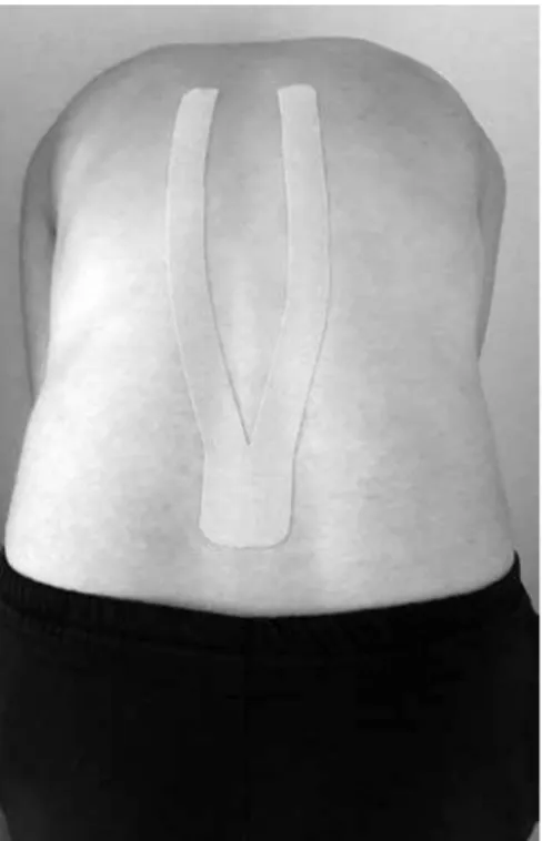 Figure 1. Kinesio taping application (while 