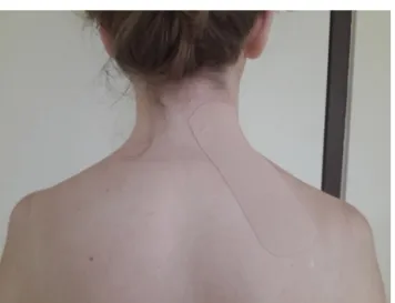 Fig. 1 – Kinesio Taping technique.