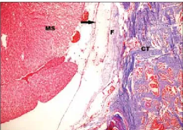 Table II: Histopathological Fibrosis Grades (8) Grade 0 No scar tissue over dura mater 