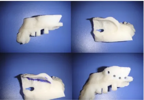 FIGURE 2. Complete or partially maxillary model was produced by using a fast prototyping machine.