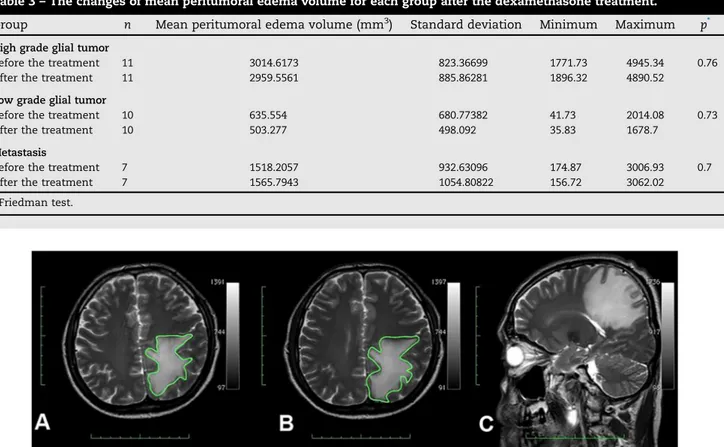 Fig. 5 – 47-Years-old male patient with left parietal metastatic tumor. (A) Peritumoral edema area in T2 axial slice before the steroid treatment