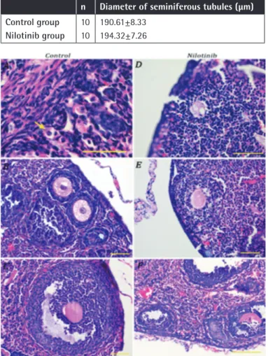 Figure  3.  Hematoxylin  and  eosin-stained  sections  of  nilotinib  group  testicle  (A)  and  a  detailed  seminiferous  tubule  (B)