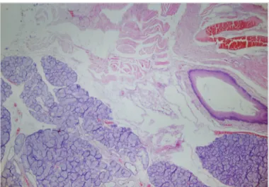 Figure 2. Hematoxylin eosin staining of 10 th  right vocal cord,  x40