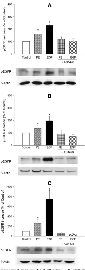 Fig. 1. Phosphorylation of EGFR (pEGFR) after 10 mM PE (10-minute) or 1 nM EGF (10-minute) stimulation in the absence or presence of EGFR tyrosine kinase inhibitor AG1478 (30 minutes preincubation) in EGFR transfected CHO cells stably expressing (A) a 1A -