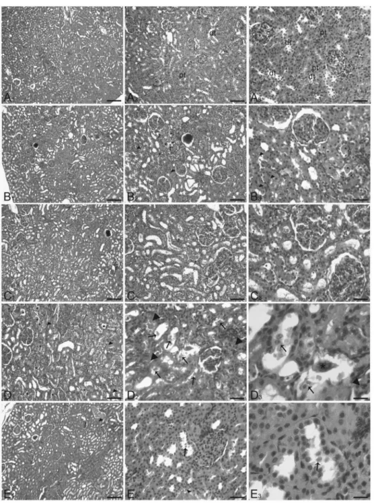 Figure 1. Light microscopy section of kidney. (A) Control rats (control group) showed no abnormalities, proximal tubules (pt), distal tubules (dt)