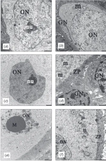 Fig. 6. Transmission electron microscopy of tissue sections from the (a, b) control group, (c, d ) slow freezing group and (e, f ) vitrification group showing: ON, oocyte nucleus; GN, granulosa nucleus; nu, nucleolus;