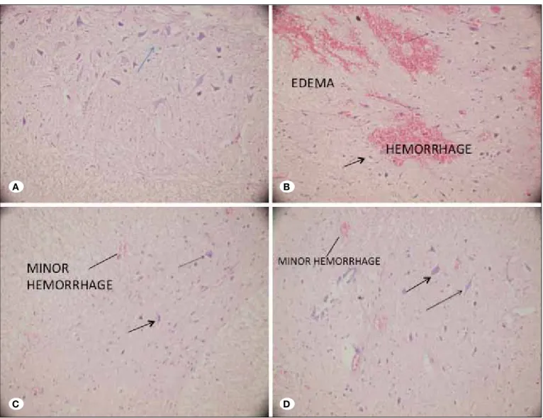 Figure 2: Photomicrographs of 5-mm-thick spinal cord tissue sections from four different groups (H&amp;E, x40)