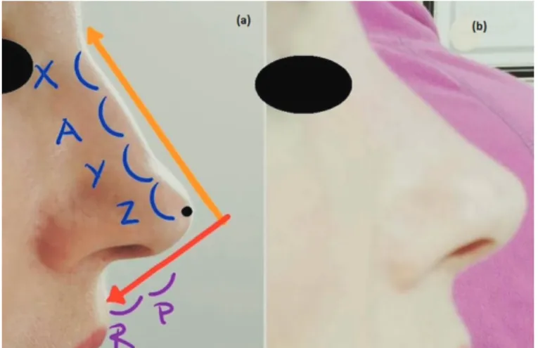 Figure 2 | Patients before (a) and immediately after (b) the procedure.