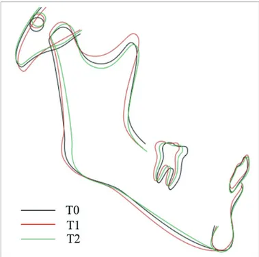 Figure 9. Intraoral and extraoral photographs of the patient after postretention period (T2)