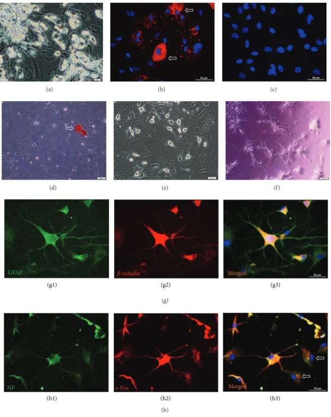Figure 3: Microscopic images of rAT-MSCs differentiated into adipocytes (a, b), osteoblasts (d), neuron-glial like cells (e), and endothelial cells (f)