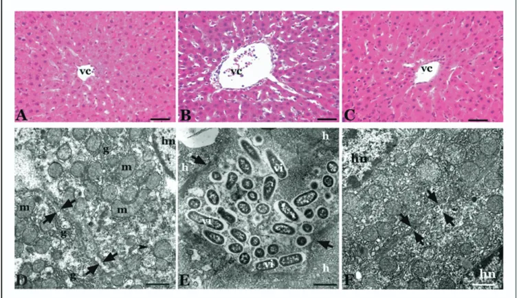 Fig. 2. The hepatocytes surrounding vena centralis (vc) in (A) group I, (B) group II, and (C) group III