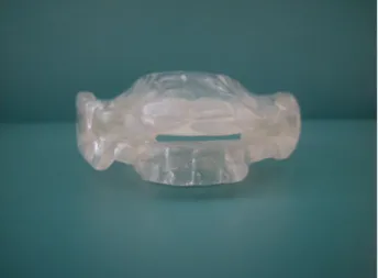 Fig. 3. Fabricated mandibular advancement device.