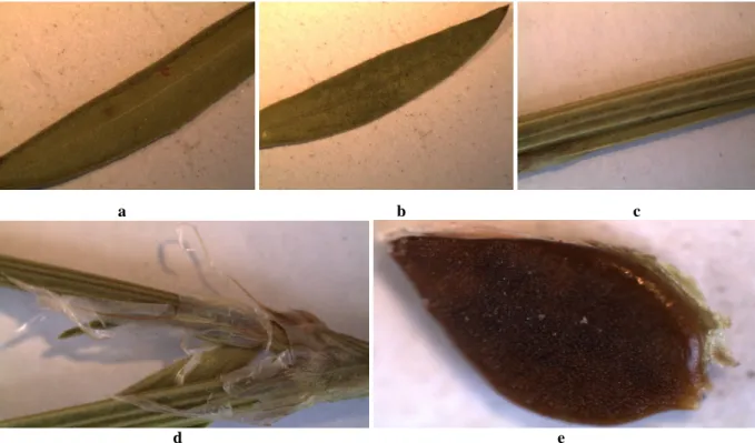 Figure 10. (a) Lower surface of leaf, (b) upper surface of leaf, (c) stem, (d) ochrea, (e) seed of P