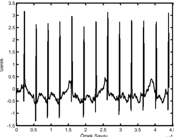 Şekil  1’de  verilen  ECG  sinyaline  SGO  oranı  7.65  dB  olacak  şekilde gürültü eklenirse Şekil 2’de gösterildiği gibi gürültülü  ECG sinyali elde edilir